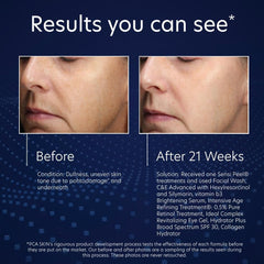Before and after comparison of skin treatment results