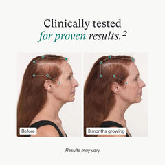 Nutrafol-Women_s-Balance-Hair-Growth-Supplement-clinical tested with prove